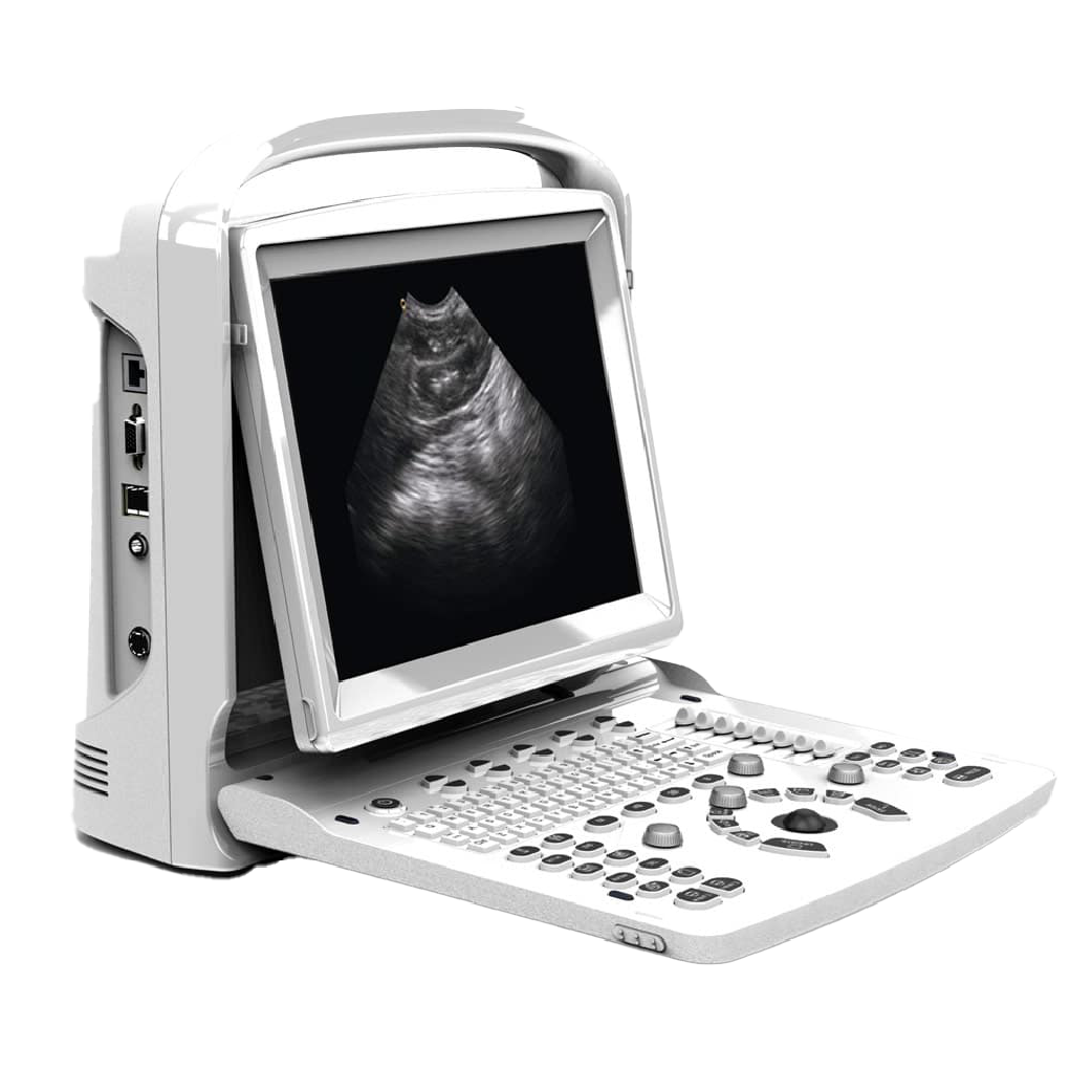 Chison ECO3 Expert echografiescanner